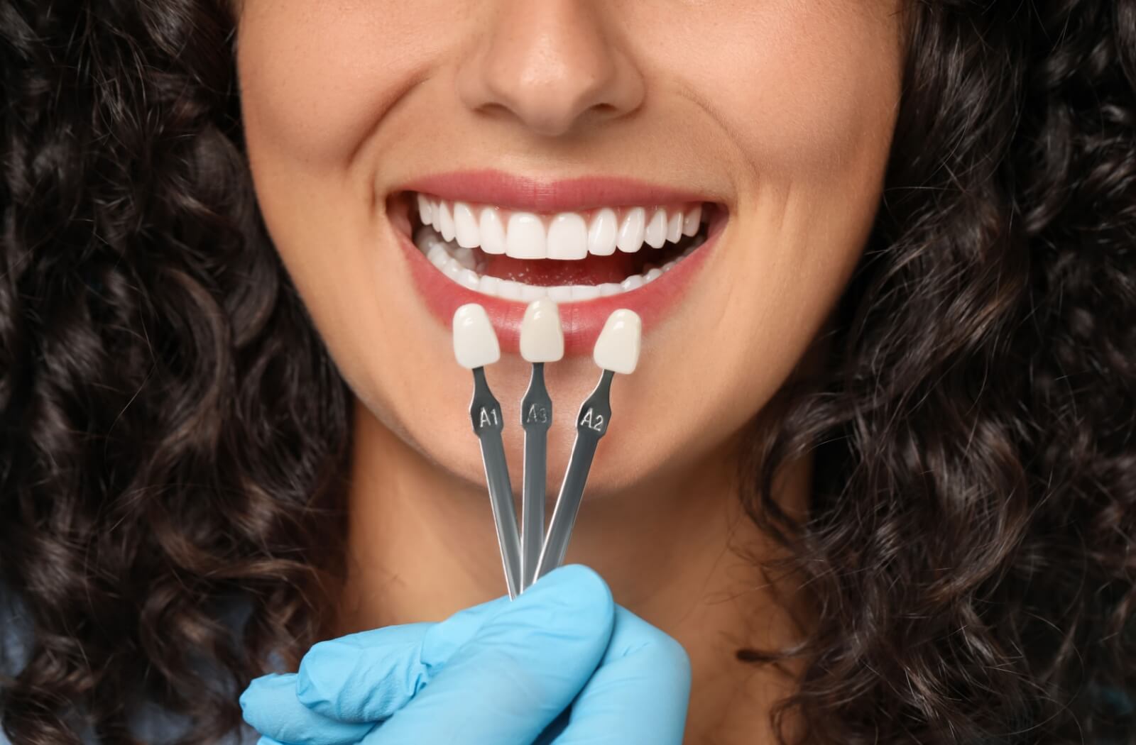 A person smiling getting their veneers color checked.