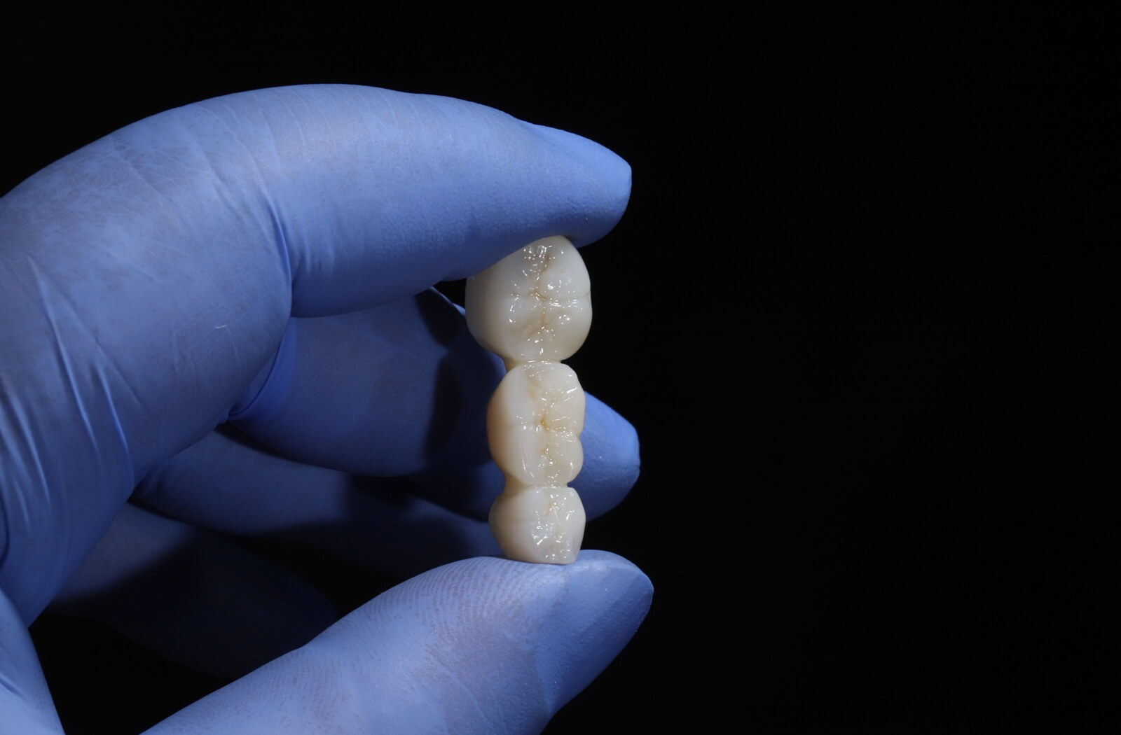 A gloved hand holding a custom dental crown.
