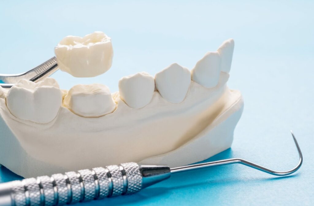A crown being placed on a fake dental model of teeth.