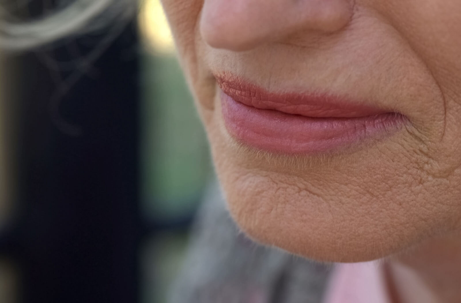 Close-up of the lower face of an older adult, showing fine lines and wrinkles around the mouth and chin.